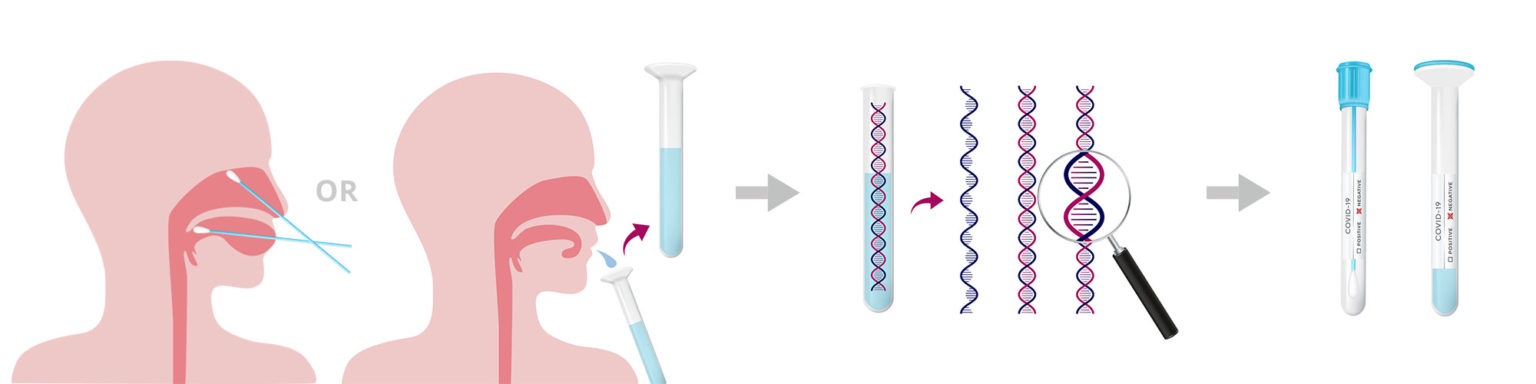 PCR vs Antigen Tests | Nexsun Diagnostic Labs