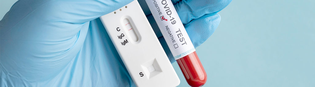 nexsunlabs-pcr-vs-antigen-test